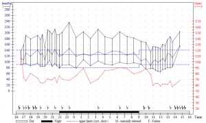 Do I need to do 24-hour blood pressure monitoring? - BHF