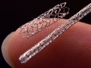 Heart Stents